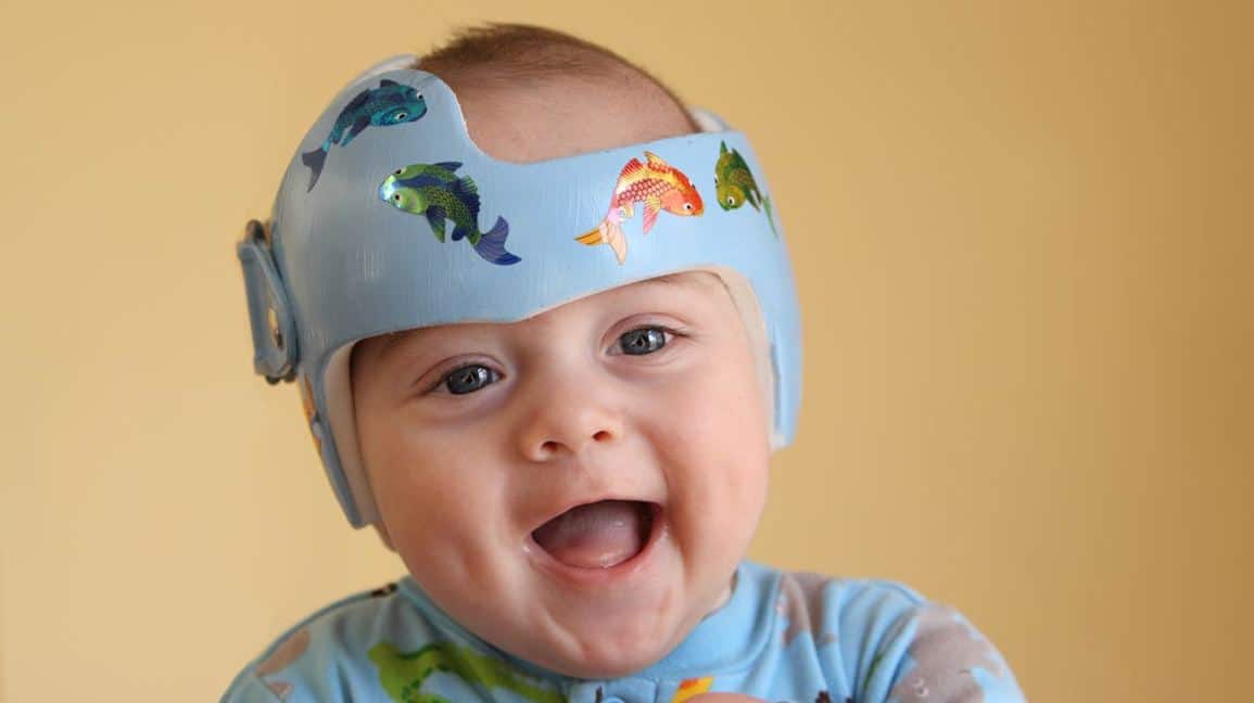 Why is that baby wearing a helmet? | Nanny Institute